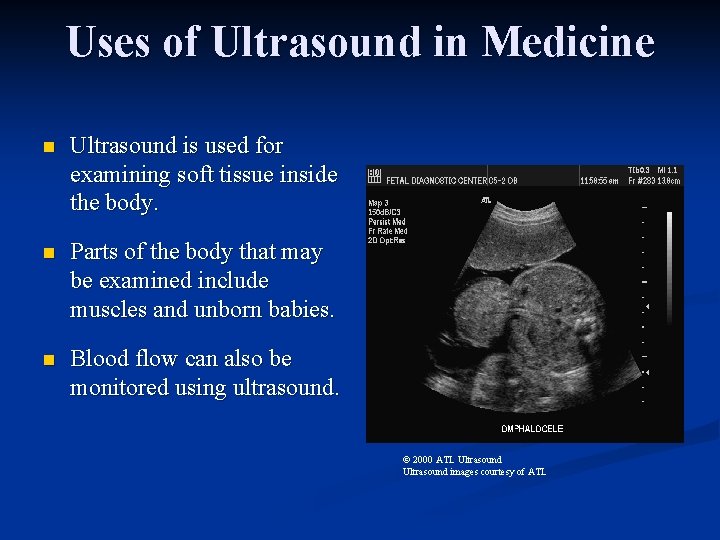 Uses of Ultrasound in Medicine n Ultrasound is used for examining soft tissue inside