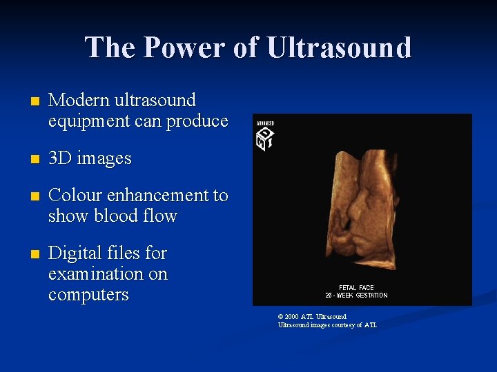 The Power of Ultrasound n Modern ultrasound equipment can produce n 3 D images