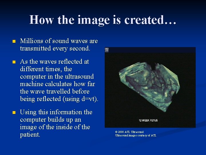 How the image is created… n Millions of sound waves are transmitted every second.