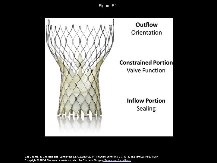 Figure E 1 The Journal of Thoracic and Cardiovascular Surgery 2014 1482869 -2876. e