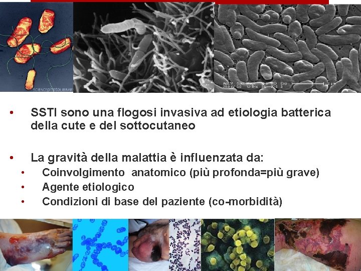  • SSTI sono una flogosi invasiva ad etiologia batterica della cute e del