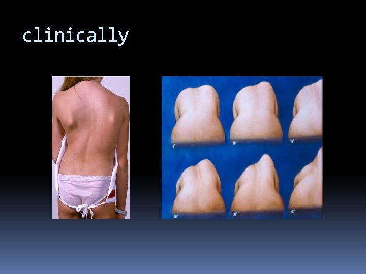 clinically clinically