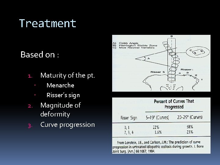 Treatment Based on : Maturity of the pt. 1. 2. 3. Menarche Risser’s sign Treatment Based on : Maturity of the pt. 1. 2. 3. Menarche Risser’s sign