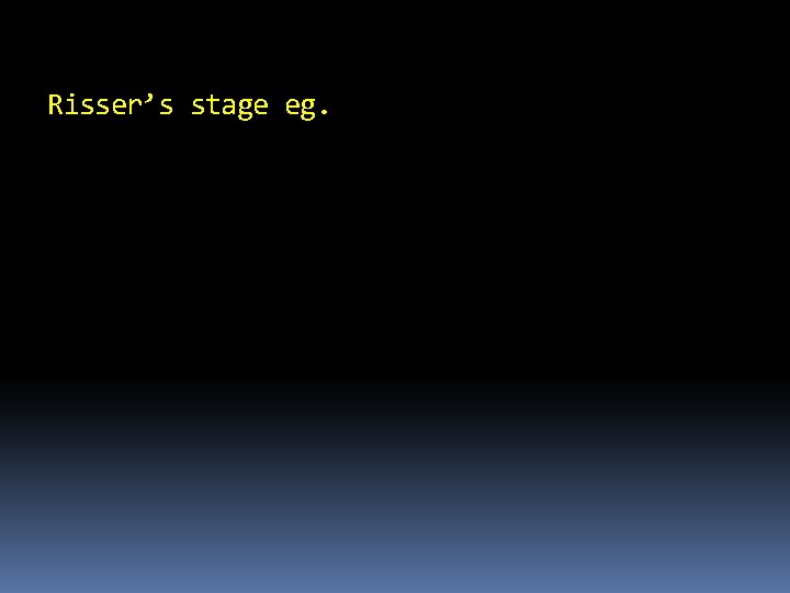 Risser’s stage eg. Risser’s stage eg.