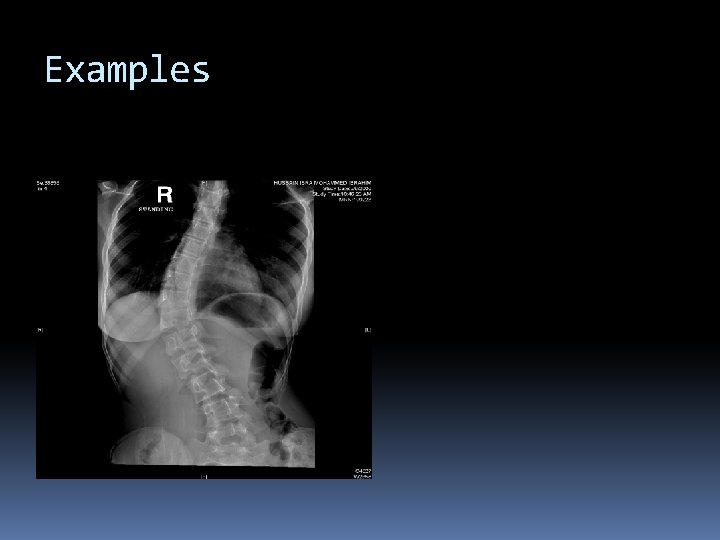 Examples Examples