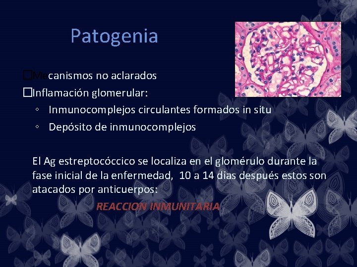 Patogenia �Mecanismos no aclarados �Inflamación glomerular: ◦ Inmunocomplejos circulantes formados in situ ◦ Depósito