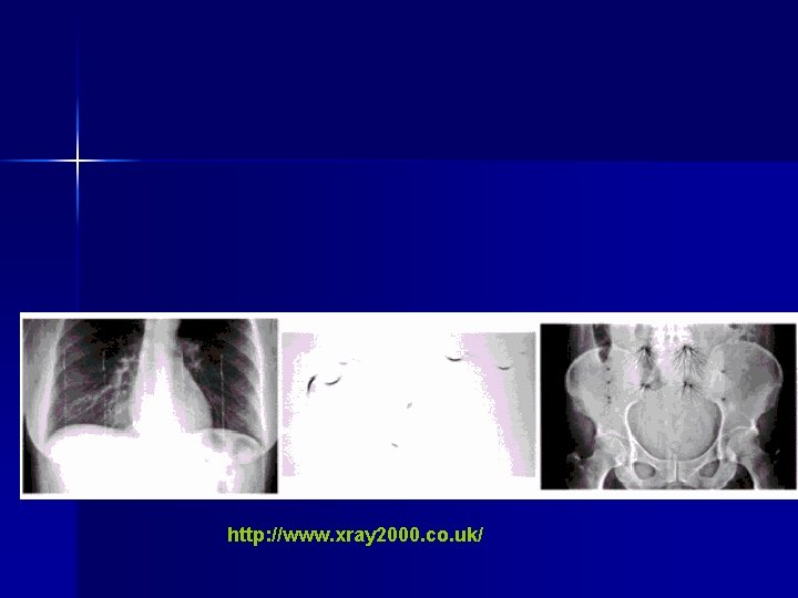 http: //www. xray 2000. co. uk/ 