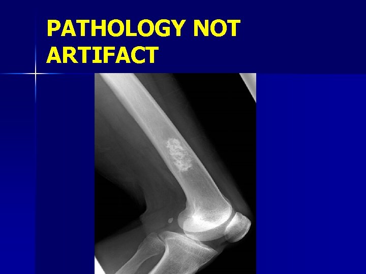 PATHOLOGY NOT ARTIFACT 