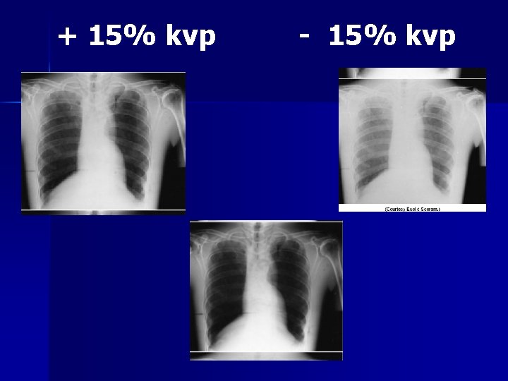 + 15% kvp - 15% kvp 