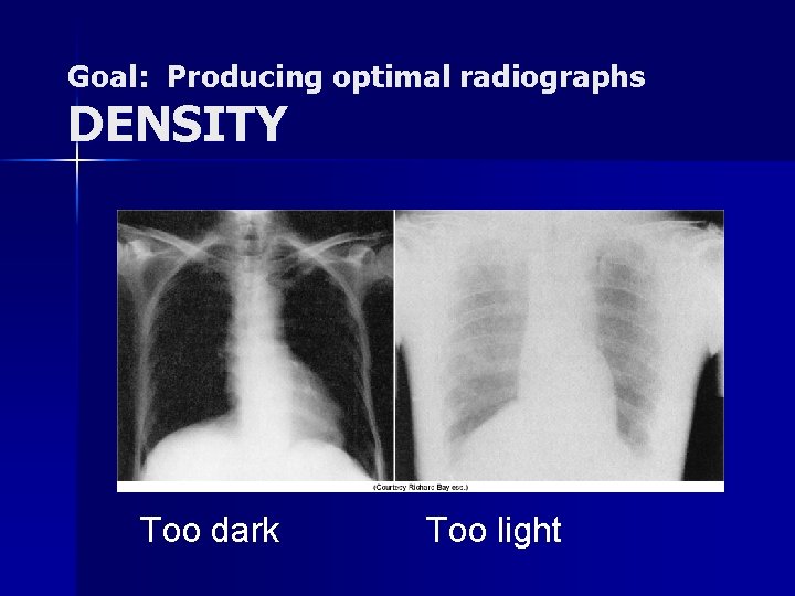 Goal: Producing optimal radiographs DENSITY Too dark Too light 