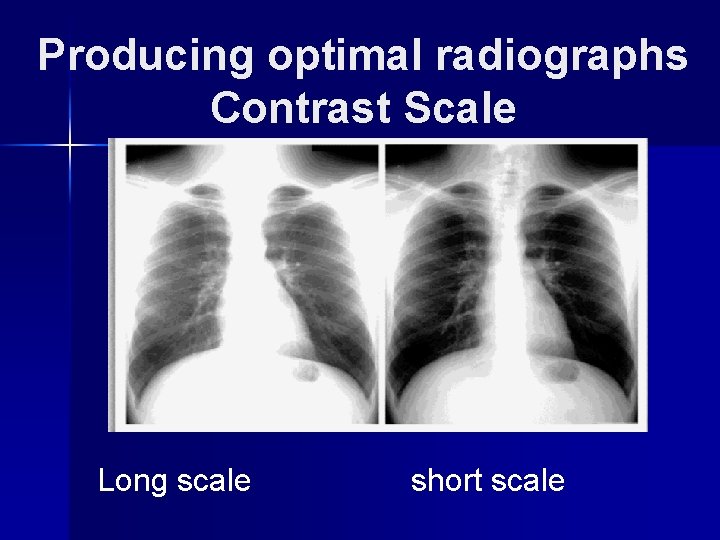 Producing optimal radiographs Contrast Scale Long scale short scale 