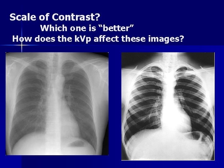 Scale of Contrast? Which one is “better” How does the k. Vp affect these