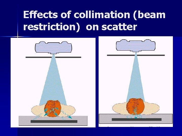 Effects of collimation (beam restriction) on scatter 
