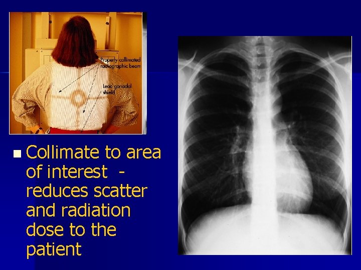 n Collimate to area of interest reduces scatter and radiation dose to the patient