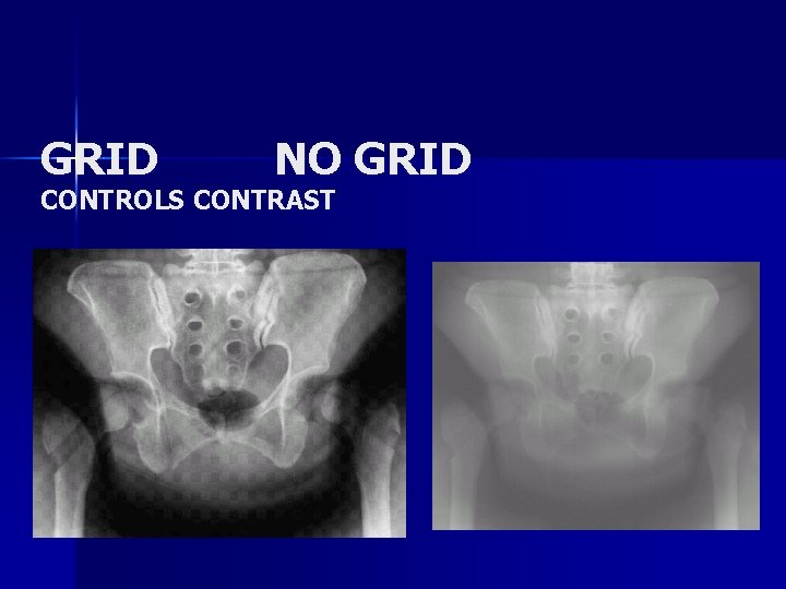 GRID NO GRID CONTROLS CONTRAST 