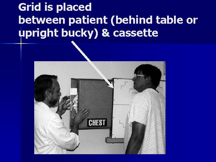 Grid is placed between patient (behind table or upright bucky) & cassette 