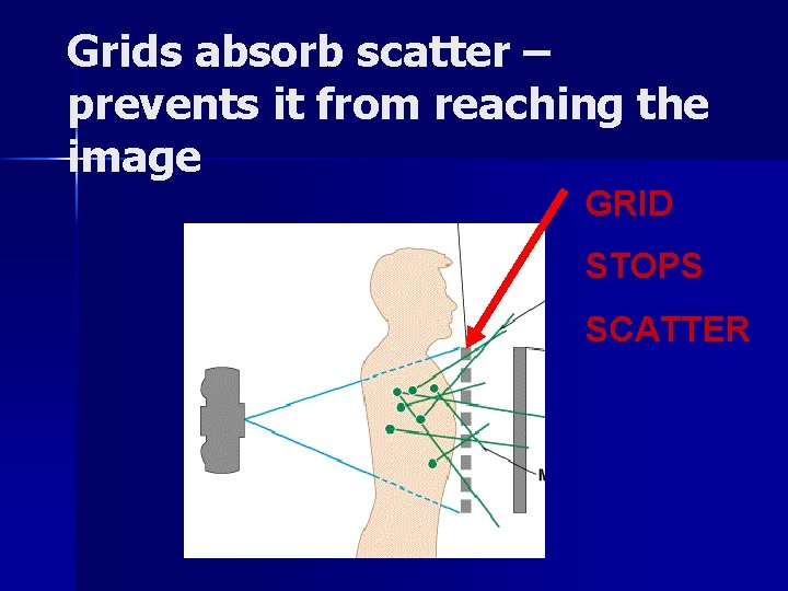 Grids absorb scatter – prevents it from reaching the image GRID STOPS SCATTER 