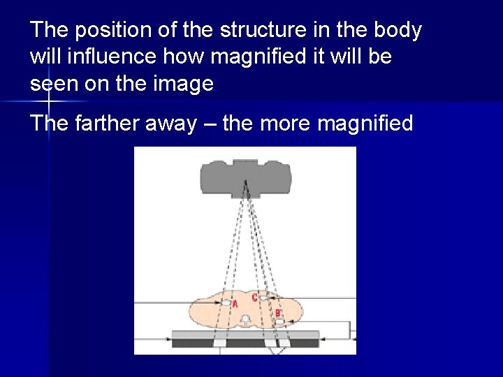 The position of the structure in the body will influence how magnified it will