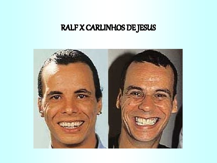 RALF X CARLINHOS DE JESUS 