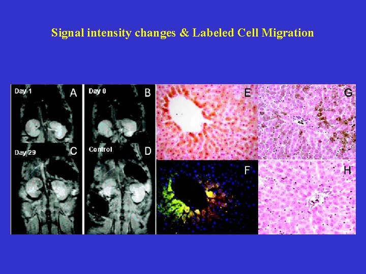 Signal intensity changes & Labeled Cell Migration 