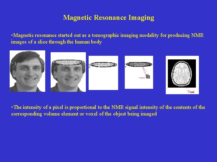 Magnetic Resonance Imaging • Magnetic resonance started out as a tomographic imaging modality for