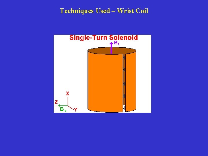 Techniques Used – Wrist Coil 