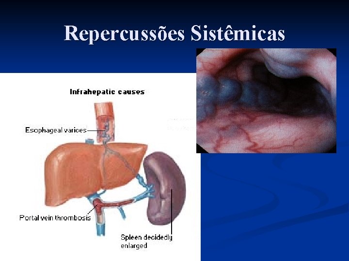 Repercussões Sistêmicas 