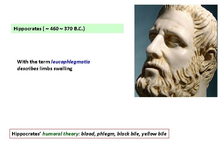 Hippocrates ( 460 370 B. C. ) With the term leucophlegmatia describes limbs swelling