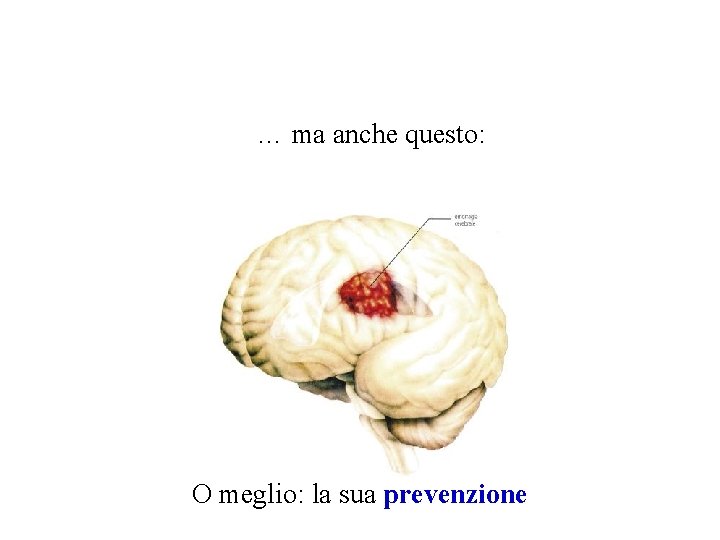 … ma anche questo: O meglio: la sua prevenzione 