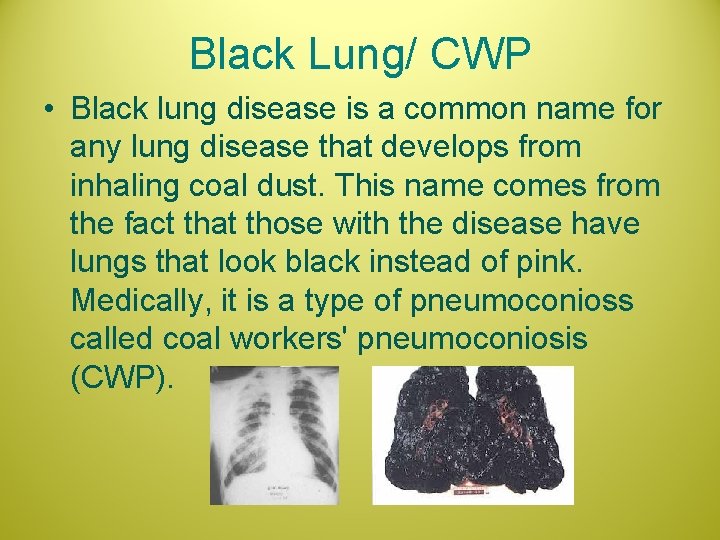 Black Lung/ CWP • Black lung disease is a common name for any lung