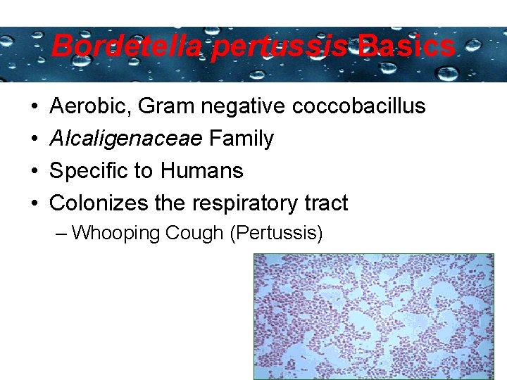 Bordetella pertussis Basics Powerpoint Templates • • Aerobic, Gram negative coccobacillus Alcaligenaceae Family Specific