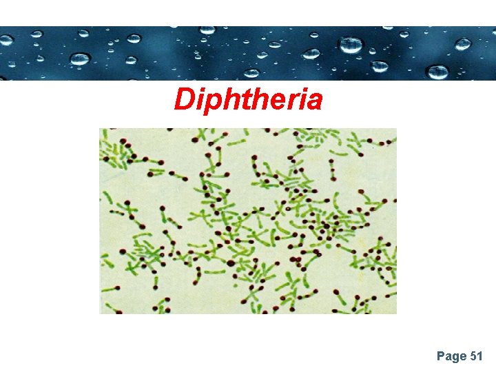 Powerpoint Templates Diphtheria Page 51 