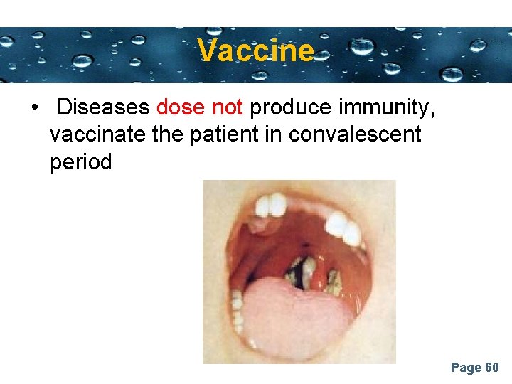Vaccine Powerpoint Templates • Diseases dose not produce immunity, vaccinate the patient in convalescent