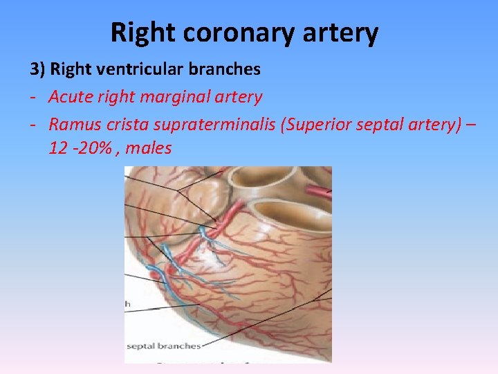 Right coronary artery 3) Right ventricular branches - Acute right marginal artery - Ramus