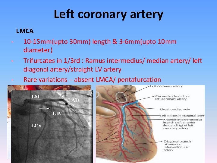 Left coronary artery LMCA - 10 -15 mm(upto 30 mm) length & 3 -6