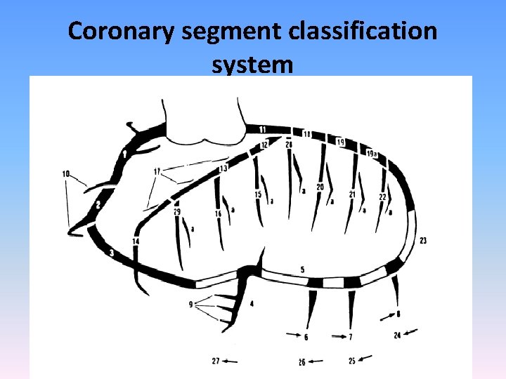 Coronary segment classification system • CASS investigators – 27 segments • BARI – 29