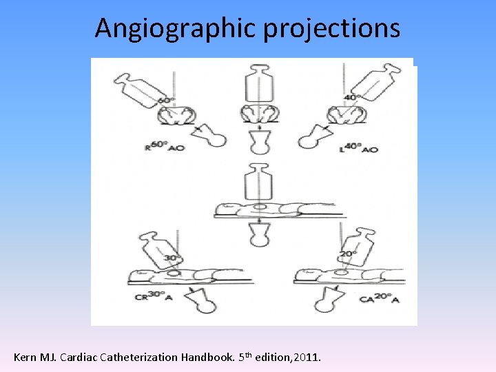 Angiographic projections Kern MJ. Cardiac Catheterization Handbook. 5 th edition, 2011. 
