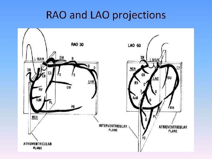 RAO and LAO projections 