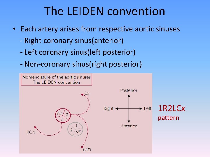 The LEIDEN convention • Each artery arises from respective aortic sinuses - Right coronary