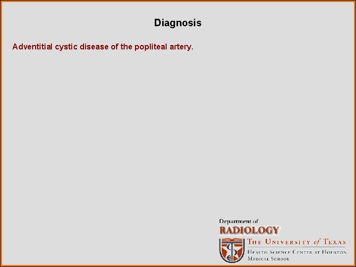 Diagnosis Adventitial cystic disease of the popliteal artery. 