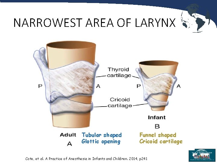 NARROWEST AREA OF LARYNX Tubular shaped Glottic opening Funnel shaped Cricoid cartilage Cote, et