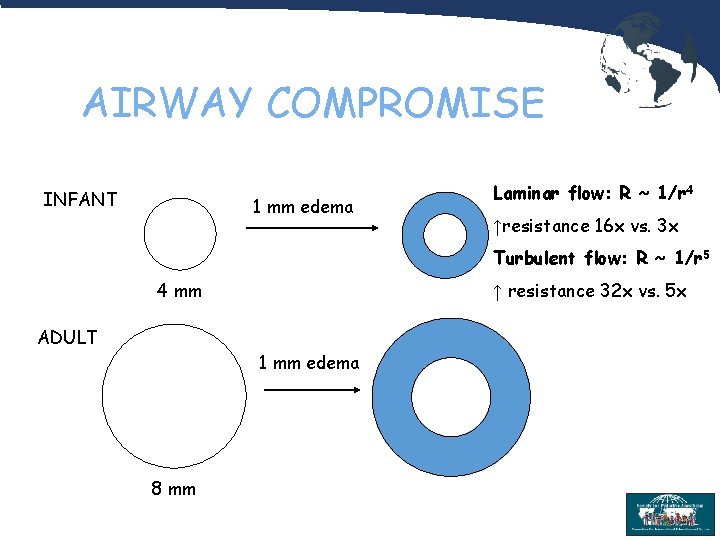 AIRWAY COMPROMISE INFANT 1 mm edema Laminar flow: R ~ 1/r 4 ↑resistance 16
