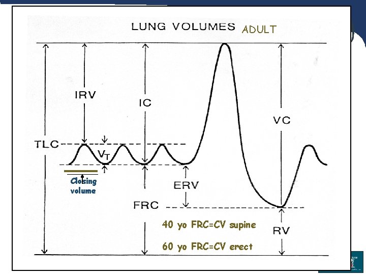 ADULT Closing volume 40 yo FRC=CV supine 60 yo FRC=CV erect 