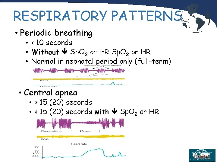 RESPIRATORY PATTERNS • Periodic breathing • < 10 seconds • Without Sp. O 2