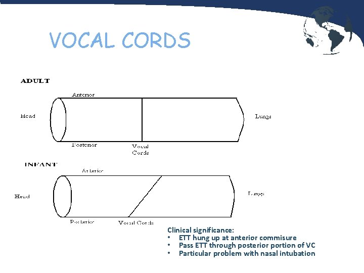 VOCAL CORDS Clinical significance: • ETT hung up at anterior commisure • Pass ETT