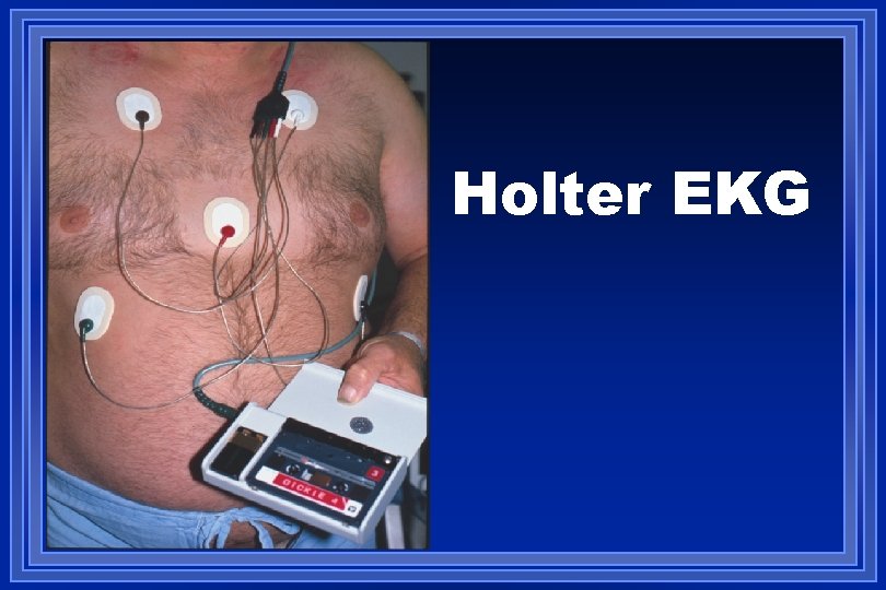 Holter EKG 