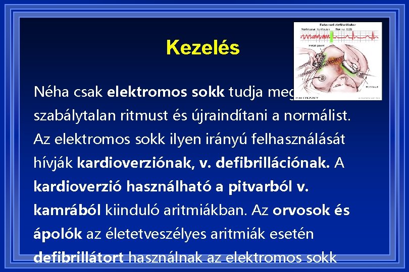 Kezelés Néha csak elektromos sokk tudja megállítani a szabálytalan ritmust és újraindítani a normálist.