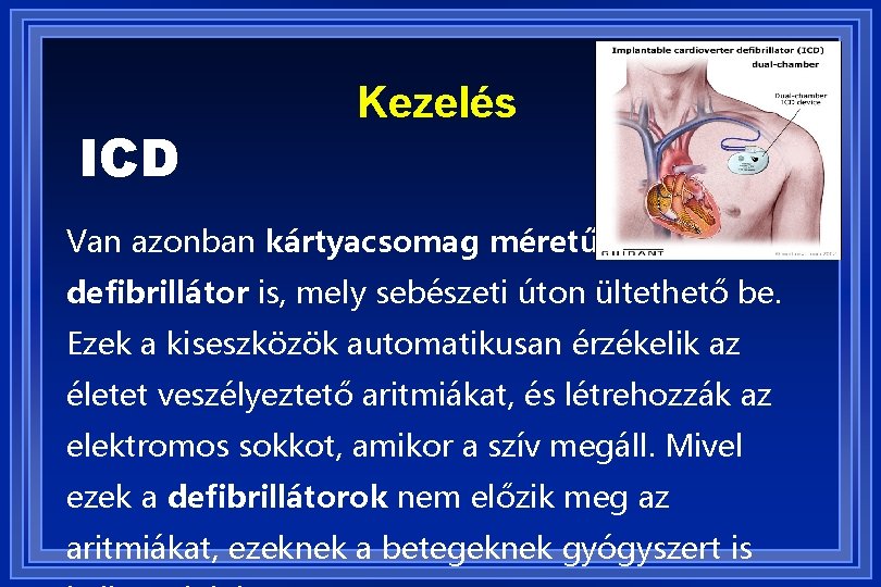 ICD Kezelés Van azonban kártyacsomag méretű defibrillátor is, mely sebészeti úton ültethető be. Ezek