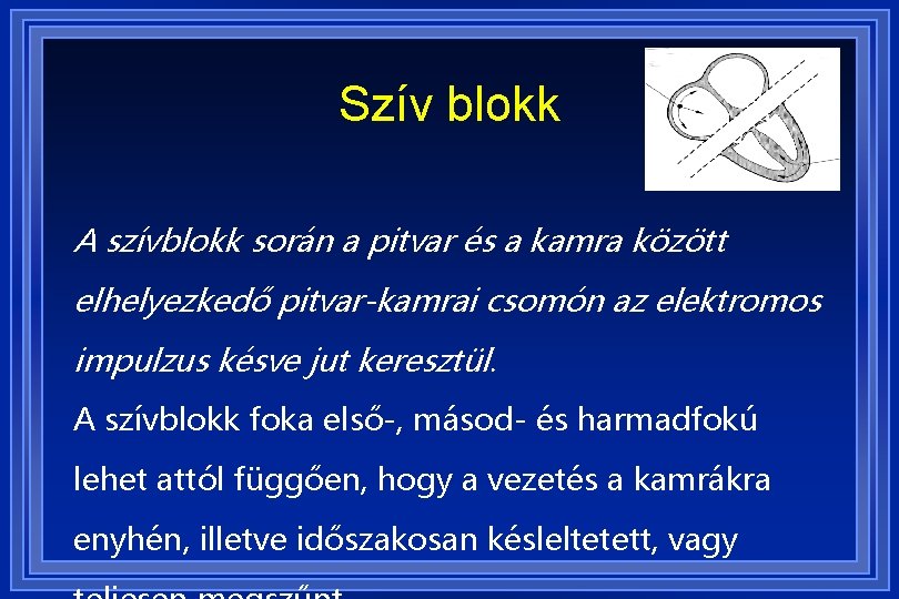 Szív blokk A szívblokk során a pitvar és a kamra között elhelyezkedő pitvar-kamrai csomón