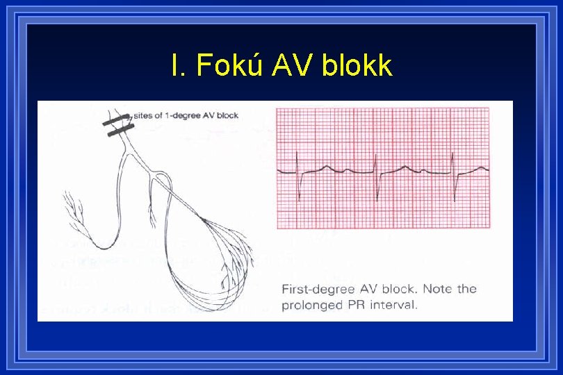 I. Fokú AV blokk 